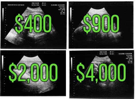 how much does a dating ultrasound cost